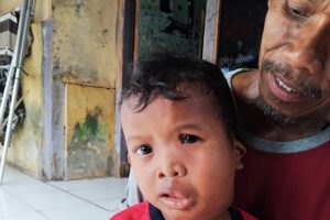 Ridho Balita Rancailat, Derita Penyakit Aneh Butuh Penanganan Medis