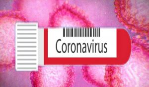 Mesin Tes Cepat Molekuler- TB, Plus Catridge untuk Covid-19 Siap Digunakan
