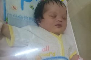 Bayi Tanpa Anus di Kabupaten Tangerang Butuh Penanganan Medis