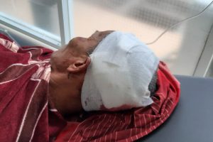 Tanpa Alasan Suami Marah Ke Istri, Bacok Tetangga dan Bakar Rumah