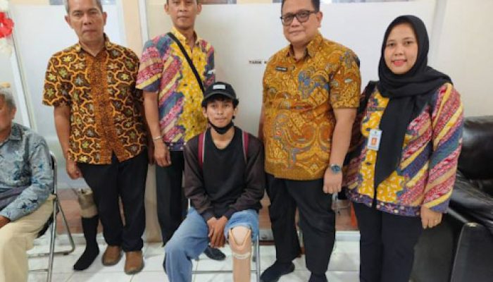 Dinsos Kota Tangerang Fasilitasi Pemasangan Kaki Palsu