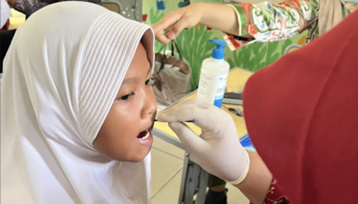 Puskesmas Batusari Deteksi Plak dan Pemberian Varnish ke Siswa SD